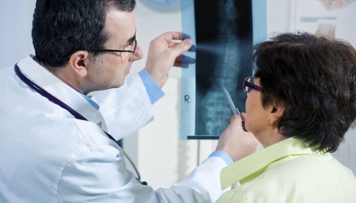 osteoxondroz ilə onurğanın rentgenoqrafiyası