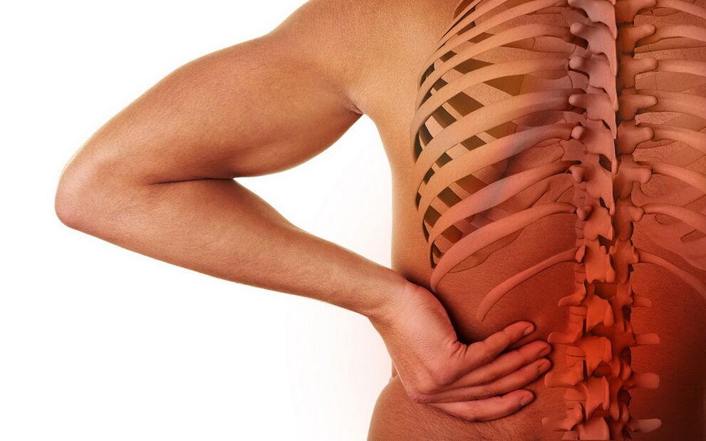 osteoxondroz səbəbiylə bel ağrısı