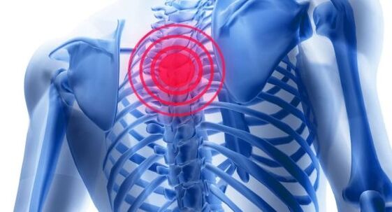 Torakal onurğanın osteokondrozunun müalicəsi