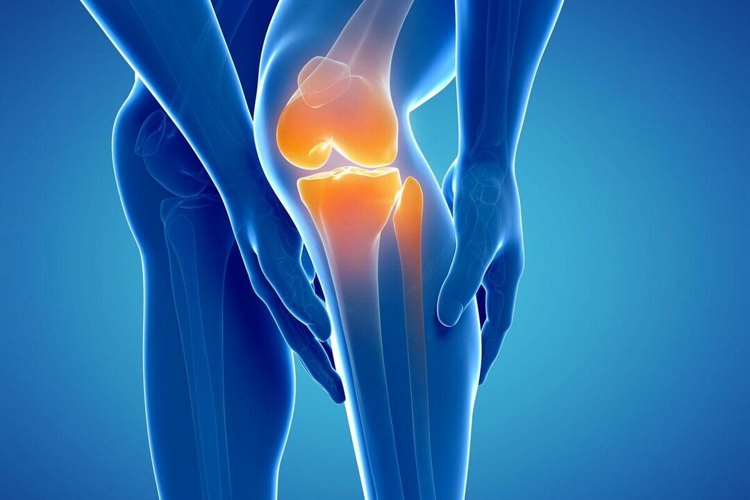Arthroz nədir