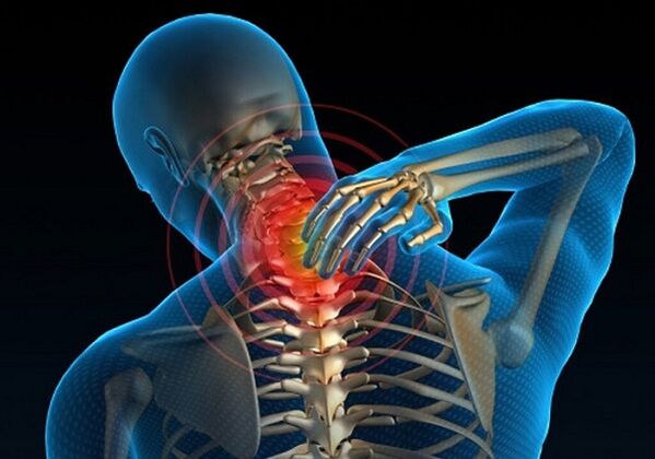 Osteokondroz səbəbiylə boyun ağrısı