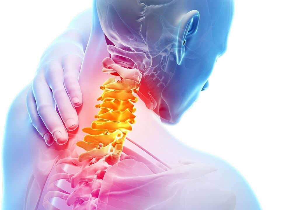 osteoxondrozun lokalizasiyası